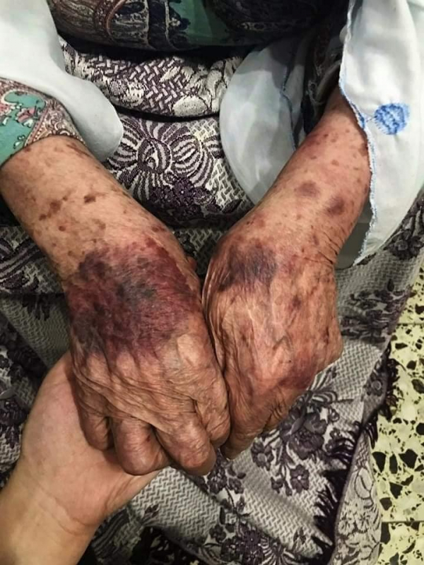 «الديمقراطية» ترفض استخدام القوة المفرطة ضد عائلة وشاح  وتدعو لتشكيل لجنة تحقيق