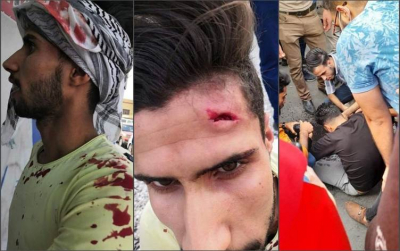 إصابات في صفوف الخريجين المتظاهرين أمام مقر وزارة الصحة العراقية