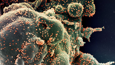 منظمة الصحة تسجل ارتفاعاً قياسياً للإصابات بكورونا في العالم