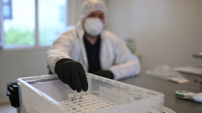 إصابة كورونا في العالم تتجاوز 17.67 مليون ووفياته 679918